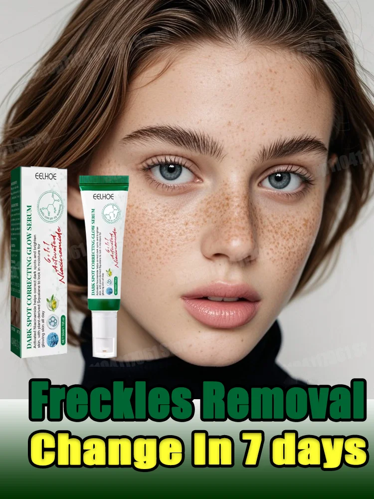 

Whitening Freckle Cream Face Brightening Cream Niacinamide Reduce Chloasma Melasma Melanin Fade Fine Lines Lighten Dark Skincare