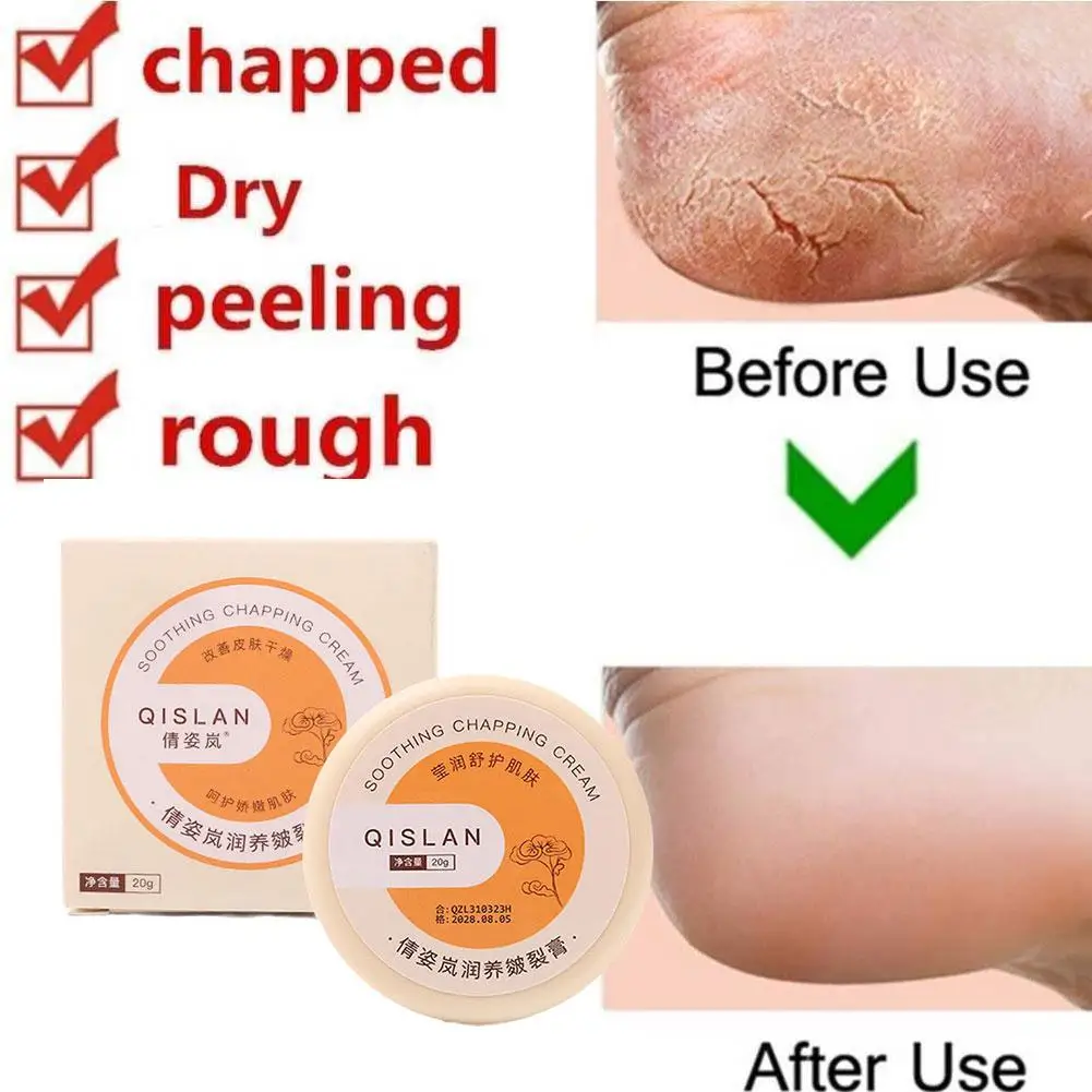 

20g Anti-drying Crack Foot Cream Heel Cracked Repair Cream Removal Dead Skin Hand Feet Care For Cracked Hands Foot Spa A1n6