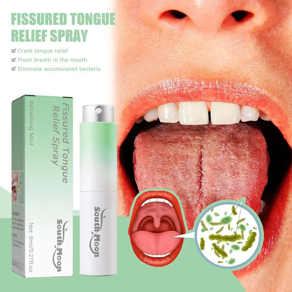 

Fissured Tongue Relief Spray Breath Freshener Spray Regulates Oral Health Mint Flavor Natural Essence Mouth Health Care 8ml