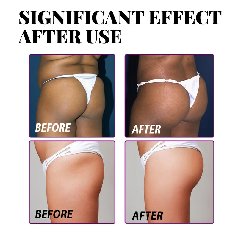 3-day Hip Big Butt Capsule Eradicate Stretch marks Increase hip lifting tightening Hip Care Health Food