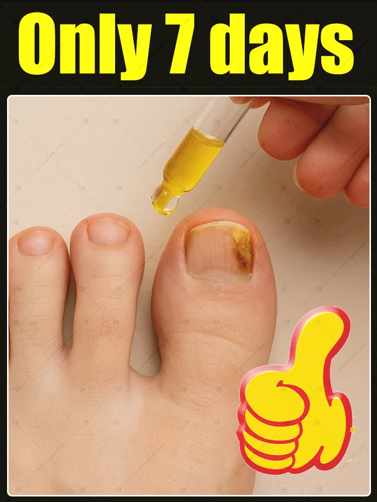 

2025 Toenail Fungus Patch Waterproof Nail Repair Patches Nail Ingrown Correction Sticker Discolored Damaged Nail Foot Care Tool