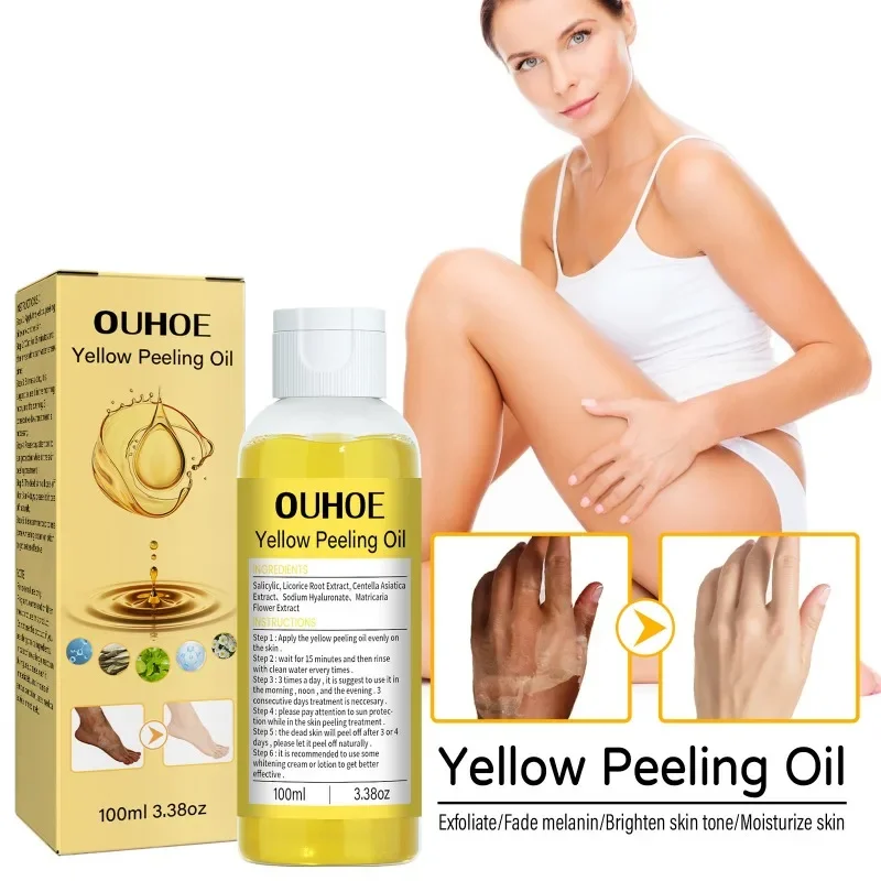 Yellow peeling oil strong exfoliating oil Lighten elbows knees Bleaching Dark melanin even skin tone and whiten Remove Dead skin