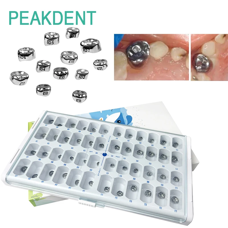 

48pcs/box Stainless Steel Baby Dental Crown Primary Molar Temporary Dental Crown Set Orthodontic Materials Dental Supplies Tools