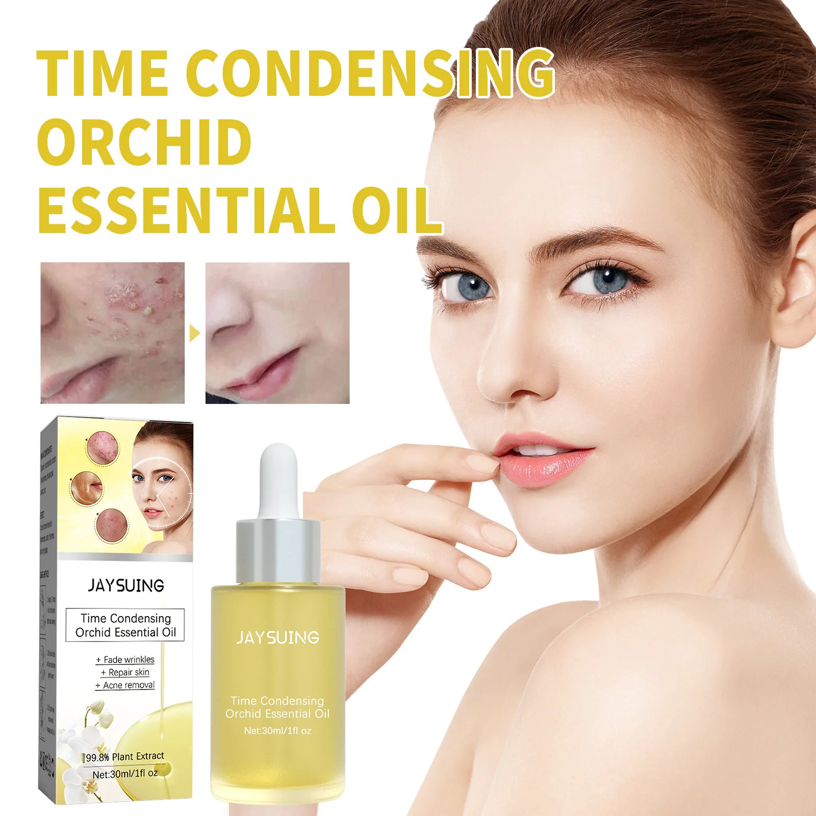 Orchid Acne Essential Oil Removes blackheads, pimples, Marks and Pits Cleansing and brightening Face Repair Essenc