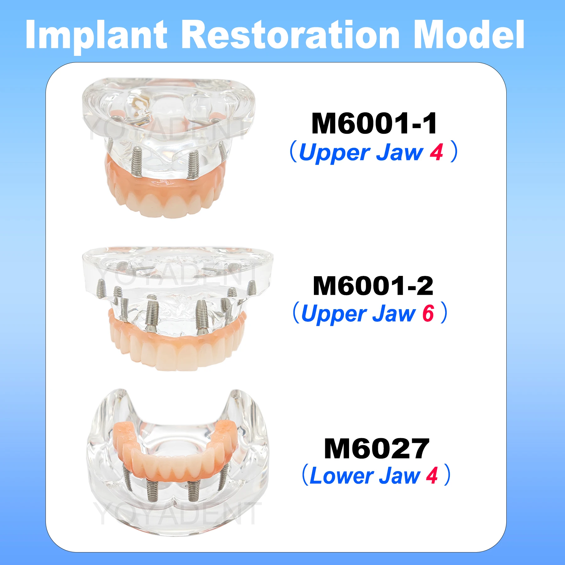 

Модель зубов зубного имплантата с 4 винтами, прозрачные модели для восстановления верхней/нижней части челюсти, инструменты для стоматолога