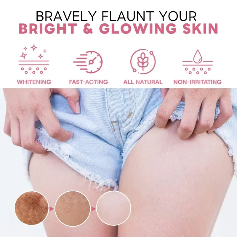 Intimate Firming cream Underarm Bleaching Whitening Private Parts Butt Knee Brighten Whiten Inner Thigh  Dark Remove Melanin