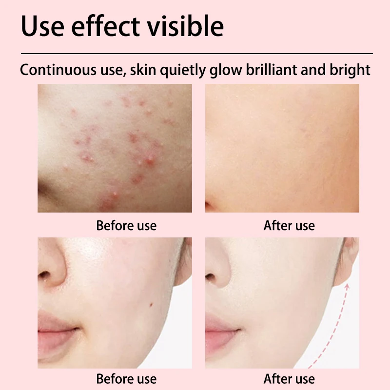 Smart Library Handheld Home Use Microcurrent Facial Toning Device Professional Rejuvenation Face Lift Machine Microcurrent