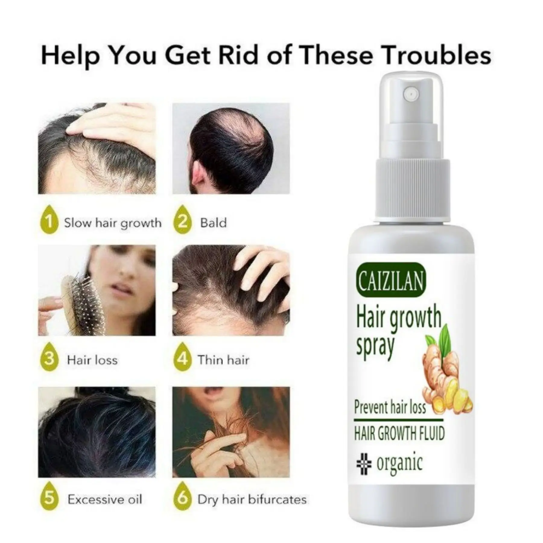 hair growth for men Ginger Hair Growth Spray Prevent Hair Loss Product Baldness Restore Scalp Treatment Germinal Hair