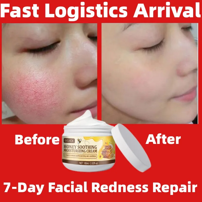 

Efficient 7 Day Repair Facial Redness Cream Sensitive Skin Sooth Anti Red Nose Acne Blackhead Pimples Shrink Pores Clearer Skin