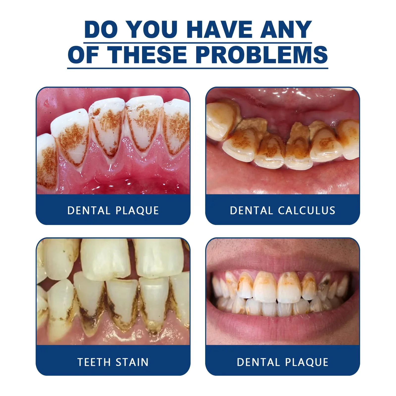 Tooth Whitening Essence Tooth Calculus Removing Dental Plaque Bad Breath Yellow Teeth Repairing Gums Teeth Cleaning Toothpaste