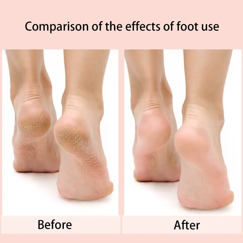 60 قطعة/صندوق إزالة النسيج مسمار الرملي ورقة مسمار بت تلميع الجلد الميت أداة تنظيف باديكير القرص ملفات القدم العالمي #5