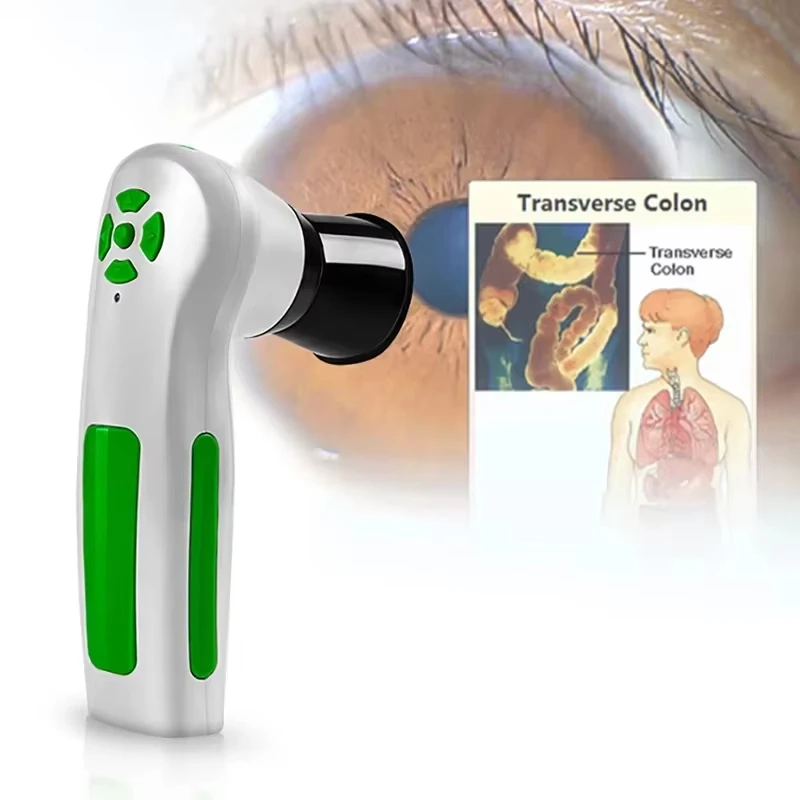 12MP HD Diagnostic Eye Camera with 30x Iris Lens Driver-Free Analysis Software High Resolution CCD USB Iriscope-A6