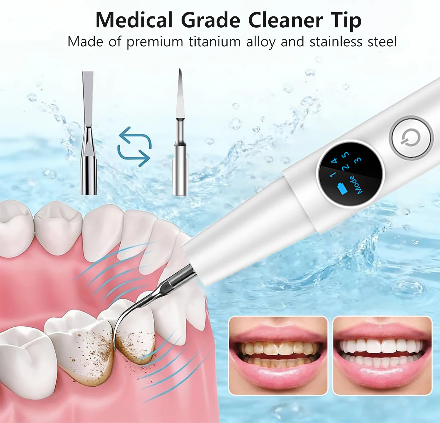 Electric Dental Tartar Remover Ultra Sonic Dental Calculus Remover Plaque Removal for Teeth Dental Scaler Tartar Eliminatorr image 3