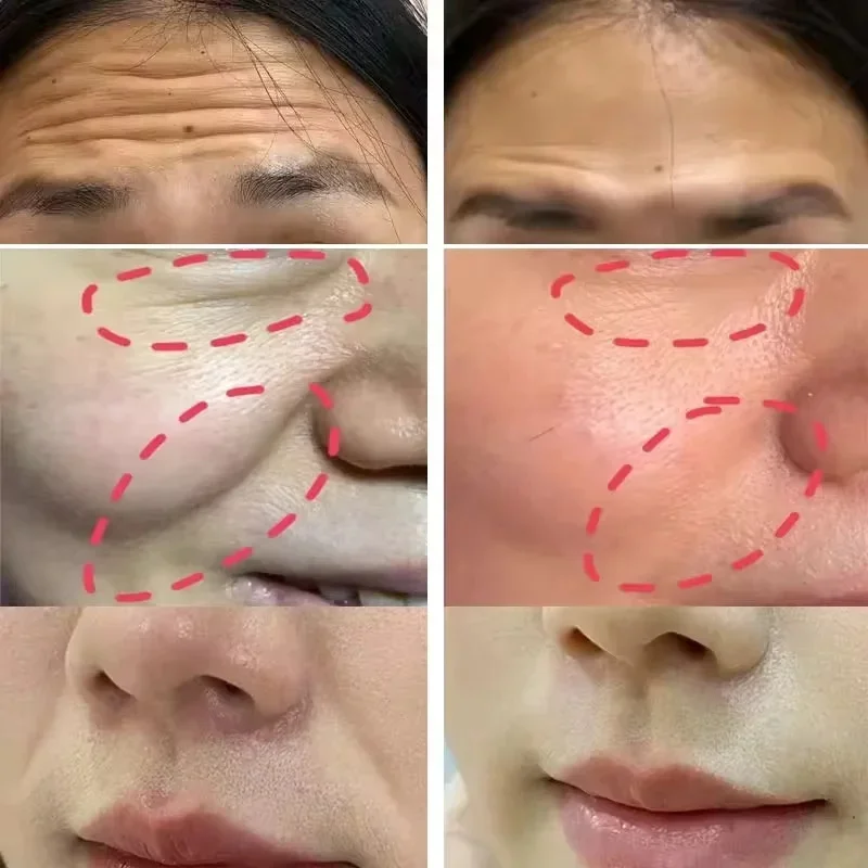 vita-um-tiro-retinal-aperto-impulsionador-soro-firme-rosto-pele-olho-rugas-removedor-essencia-hidratante-iluminar-coreano-original