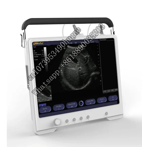 

Digital Laptop TS20 Portable Ultrasound Scanner Device