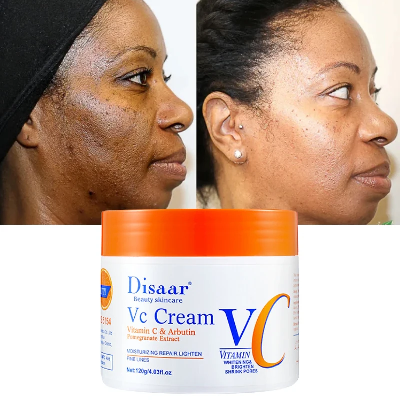 Vitamina C sbiancante lentiggini crema viso rimuovere Melasma macchie scure schiarire melanina Anti-età illuminare la cura della pelle coreana 120g