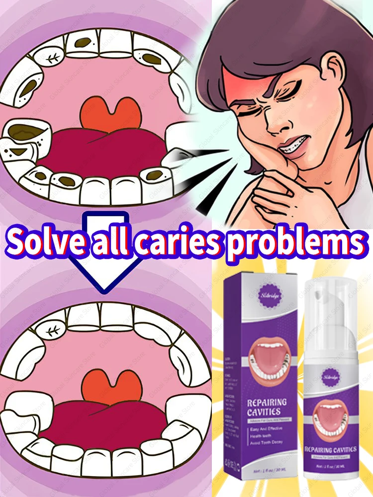 

Solves caries and tooth decay problem