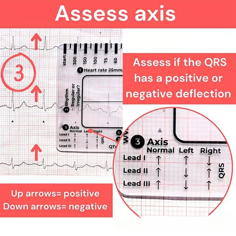 7 Step Ruler, Ruler Plastic Ruler Measuring Tool, 7 Step Ruler For Interpretation, Transparent EKG Calipers Measuring Tool