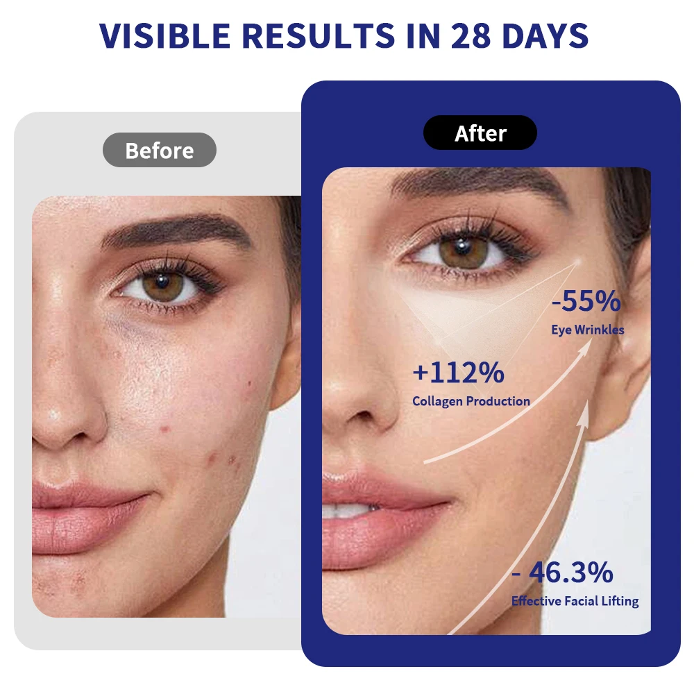 آلة شد الجلد مكركرنت RF EMS 3 في 1 جهاز مكافحة الشيخوخة الاهتزاز العلاج بالضوء الأحمر لرفع الوجه وإزالة التجاعيد #4