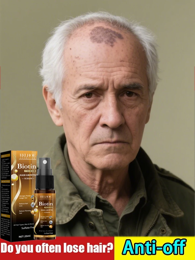 

Solve your problem and let us have Better hair