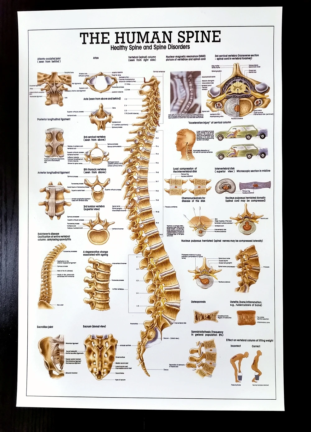 THE HUMAN SPINE PVC Waterproof Poster Heaithy Spine Disorders Wall Chart HD Medical Poster Hospital Clinic Home Decoration 0p