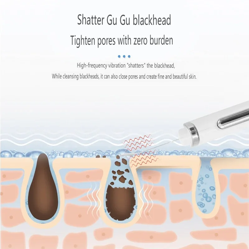 جهاز تجميل الوجه الكهربائي، ESM، تيار صغير، الموجات فوق الصوتية، تدليك الاهتزاز، تنظيف المسام، الرفع، USB ML-071