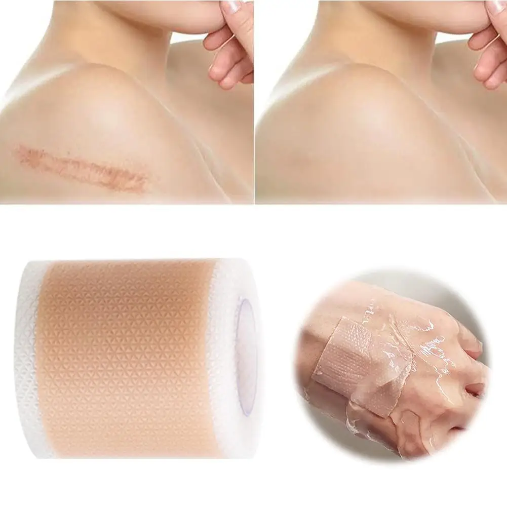 4X150CM Silicone Scar Patch Skin Repair Sheets Removal Self-Adhesive Stretch Mark Tape Therapy Patch Burn Acne Scar Skin Care ﻿