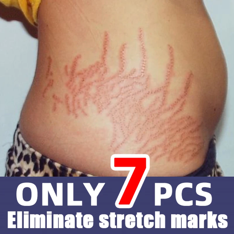 

Stretch Mark Repair Cream For Pregnant Women Postpartum Care Firm Light Lines Obesity Lines Growth Lines Repair Cream New