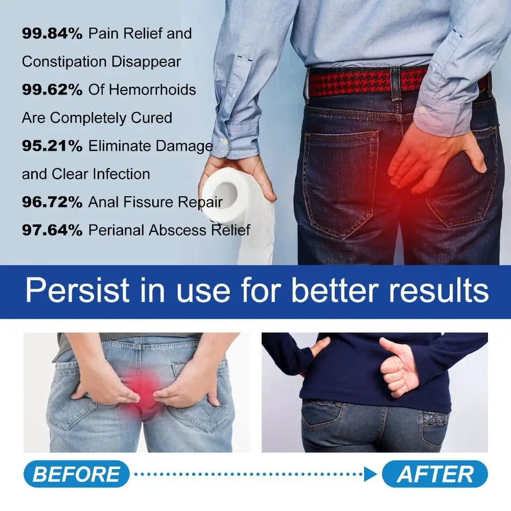 Cápsulas de hierbas naturales para aliviar las hemorroides, herramienta de reparación para aliviar el dolor de ano no estimulante