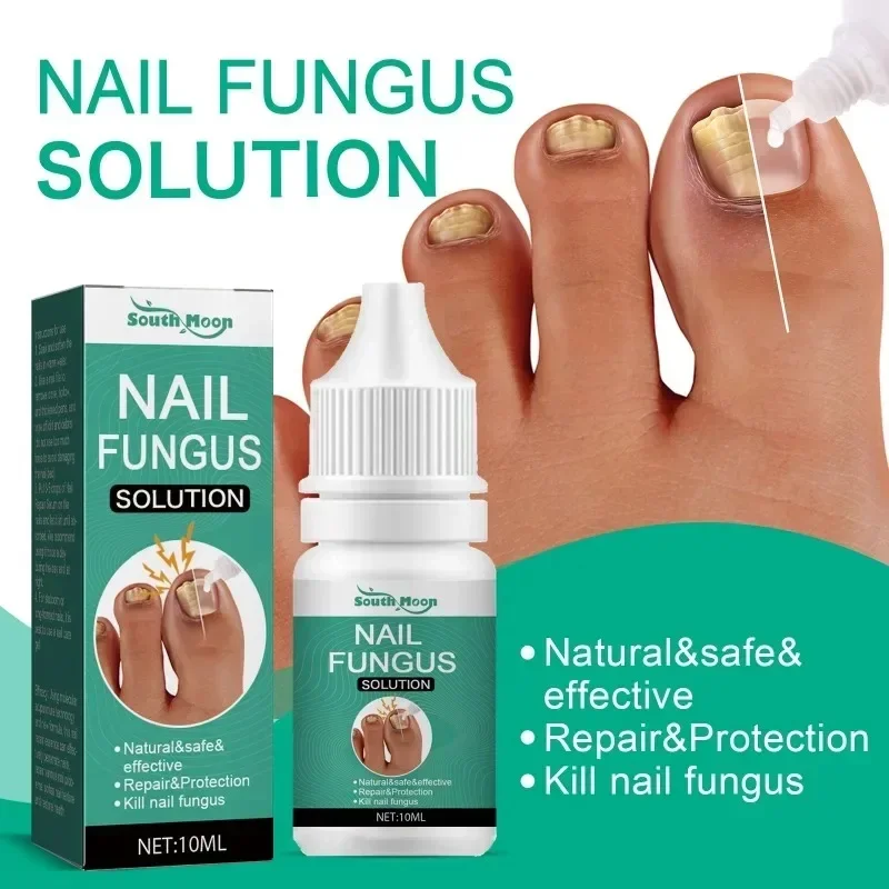 Nail Care Face Serum Solution Hand Foot Care Toenail Thickening Yellowing Care Essence Ingrown Nail Gray Bright Nail Repair