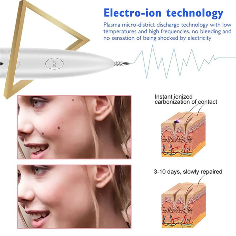 Caneta de plasma ponteiro laser verrugas papiloma mole espinhas remoção da tatuagem etiqueta da pele removedor de cravo cuidados com a pele beleza