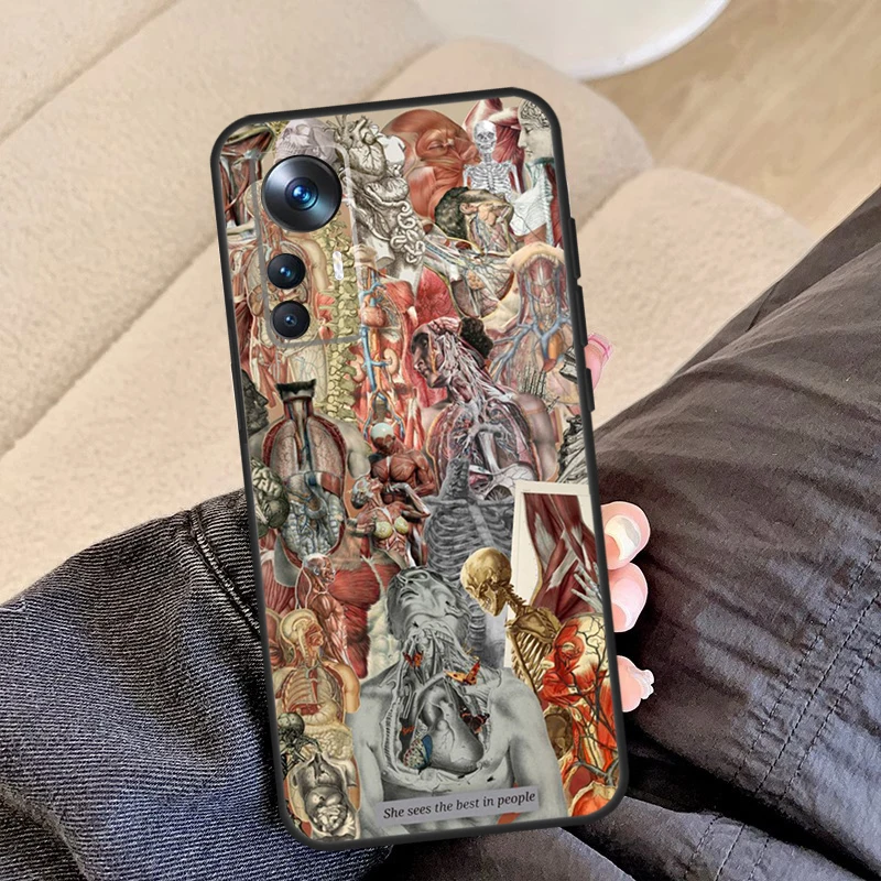 Human Organs Brain Kidney Medical For Xiaomi 15T 13T 14T 17 Pro Max 14 15 Ultra Case For POCO F8 Ultra F5 F6 F7 X5 X6 X7 X8 Pro