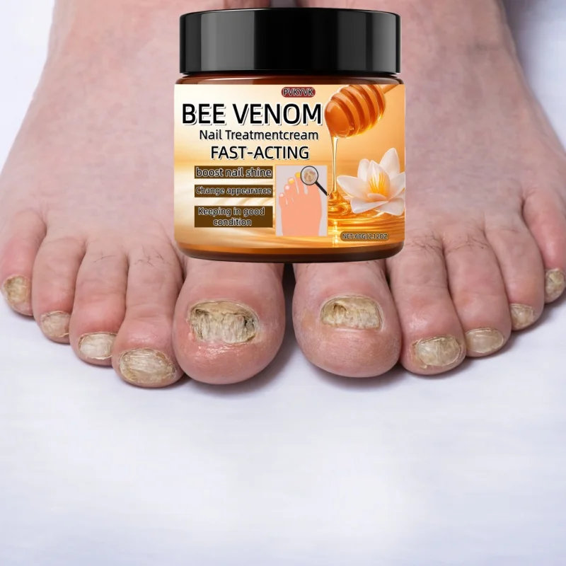 owerful nail cream, suitable for dry, rough, fragile nail care, hardening, yellowing, quick absorption,moisturizing, smoothing,