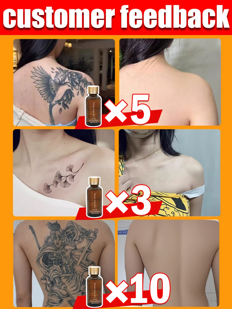 Fade stubborn tattoos effective in removing permanent tattoos