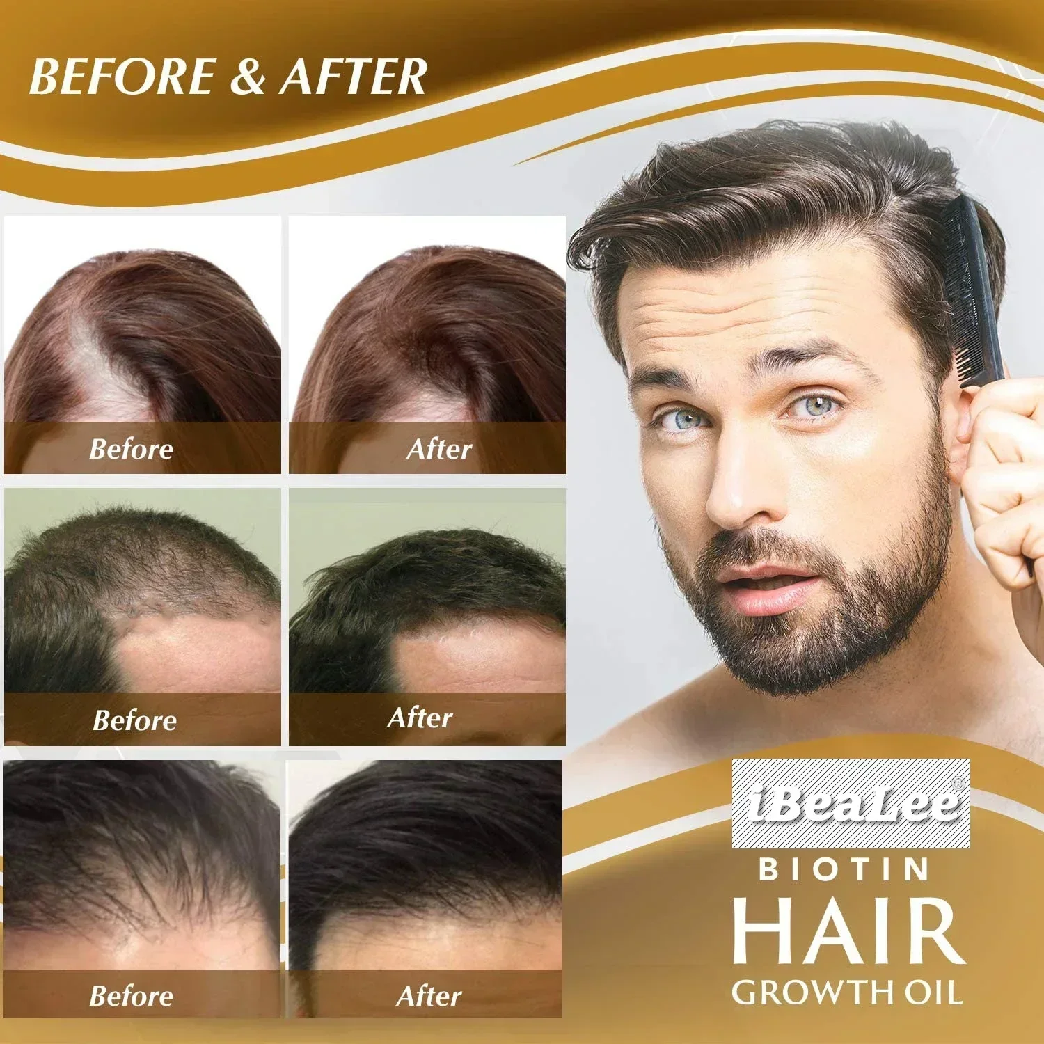 IBeaLee Produtos para o crescimento do cabelo Biotina Anti Perda de cabelo Spray Tratamento do couro cabeludo Crescimento rápido Cuidados com os cabelos Óleos essenciais para homens e mulheres