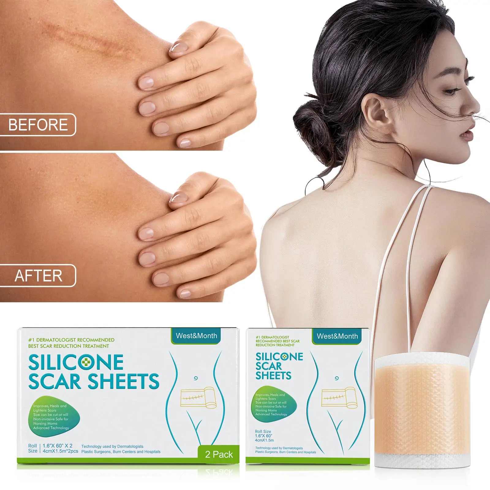 ซิลิโคนรอยแผลเป็น Patch ผิวแผ่นซ่อมกําจัด Self-Adhesive Stretch Mark เทป Therapy Patch Burn สิวรอยแผลเป็น Skin Care