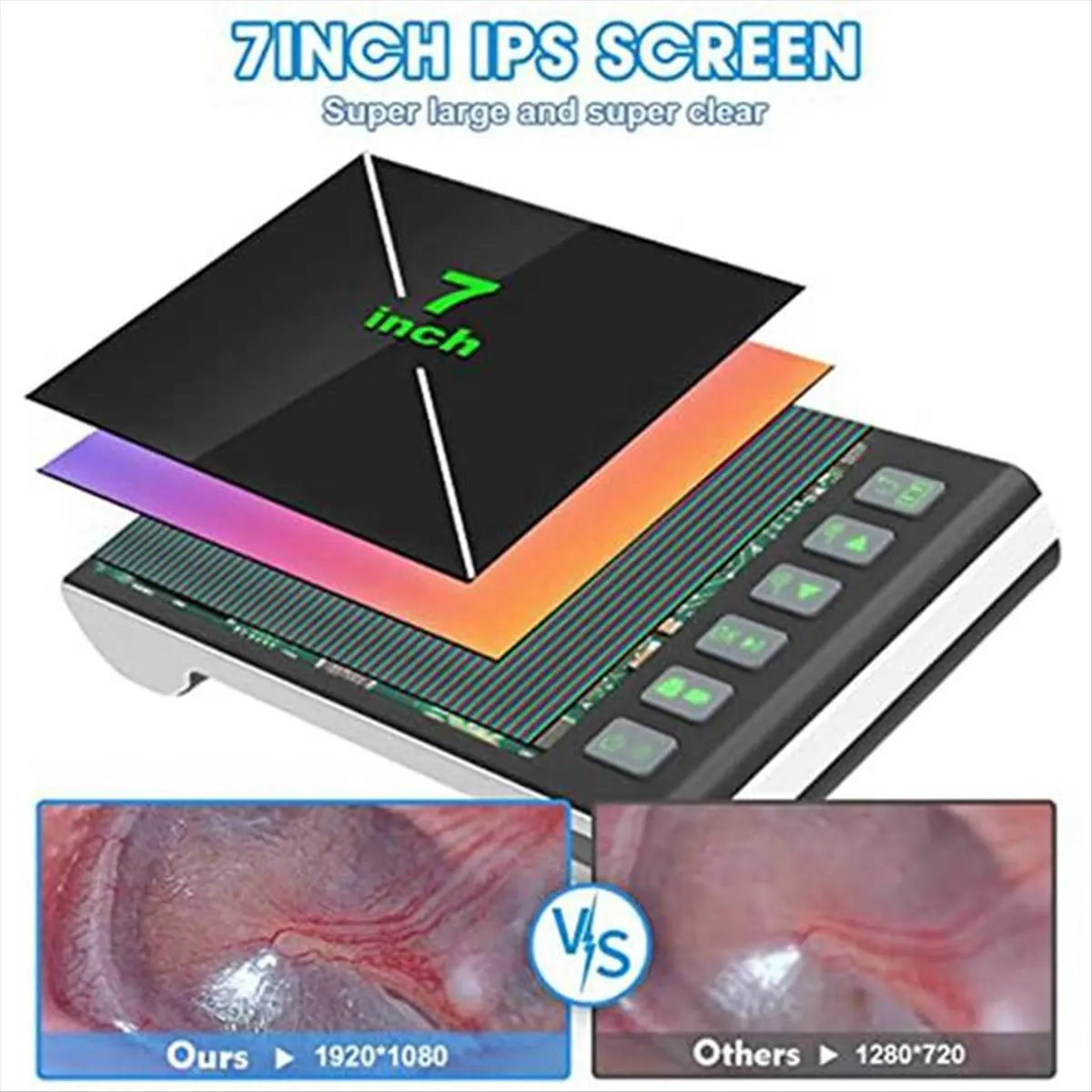 

Цифровой отоскоп с 7-дюймовым экраном, ушной камерой и визуальным ушным зондом, поддерживает фото- и видеозапись (32 ГБ)