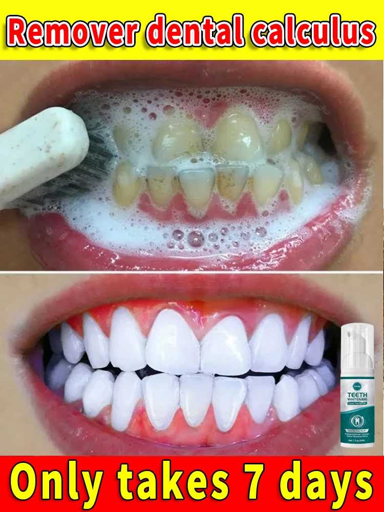 

Solve all dental problems