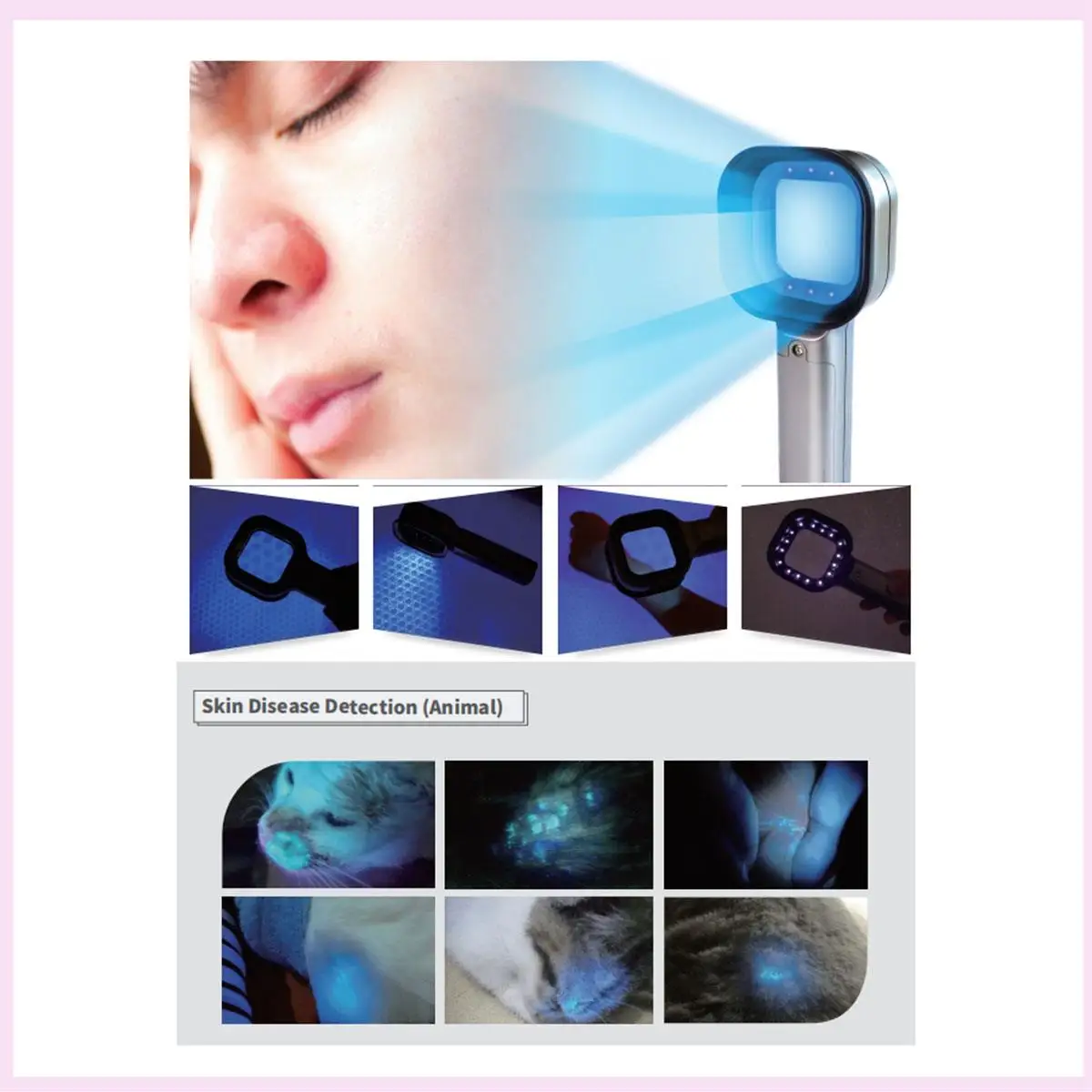 B25B Portable Facial Salon Beauty Analyzer Skin Analyzing Testing UV Woods Lamp For Skin Care