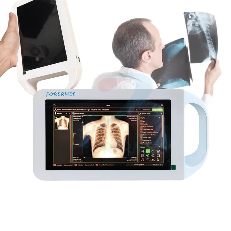 

Handheld DR X Ray 80 Kv Digital Xray Chest X-ray Machine Optional Wireless Digital Flat Panel Detector Portable X Ray Machine