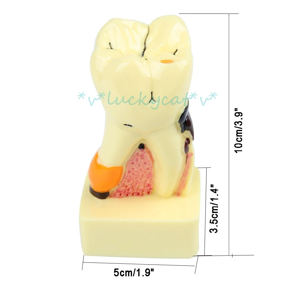 1pcs new Oral dental model 4 times transparent molar profile model with nerve pattern details For Dental Lab item model tool