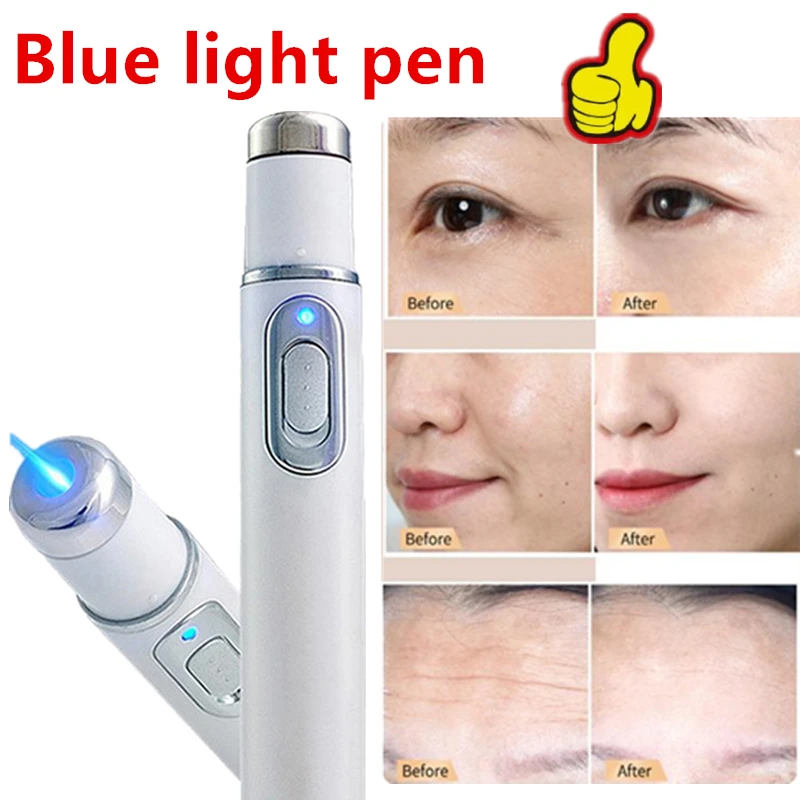 Cerchi per occhi neri a luce blu Strumento per la cura del viso Dispositivo per la bellezza del viso Massaggiatore per occhi Texture schiarente Manutenzione delle borse per gli occhi