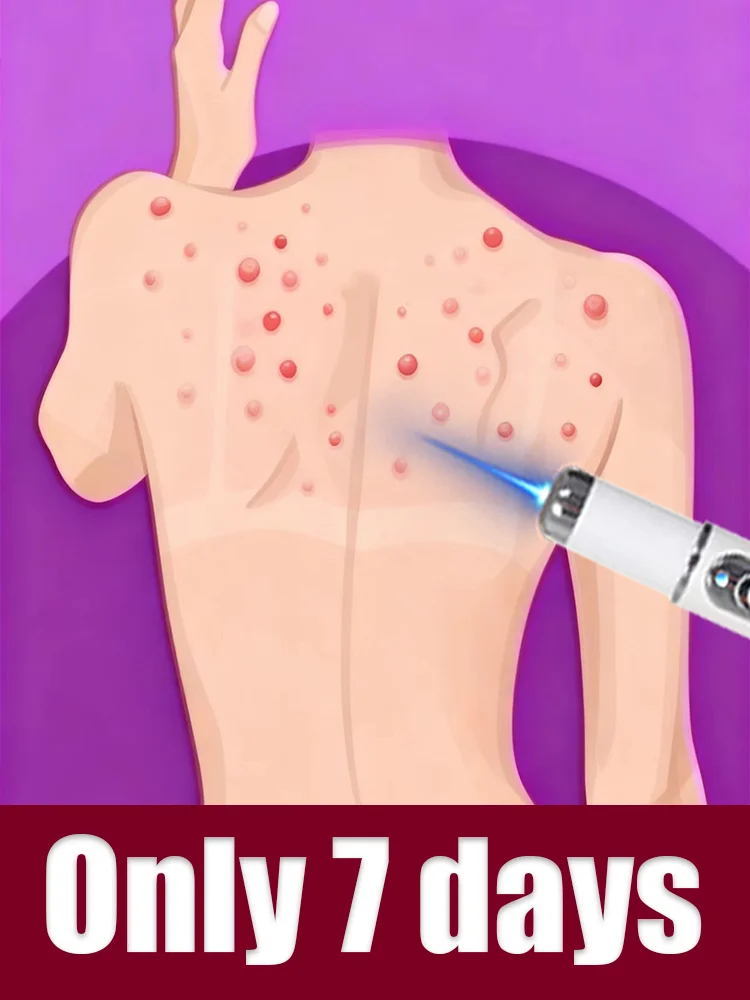 

Eliminate all types of warts at their source and lighten raised and sunken warts.