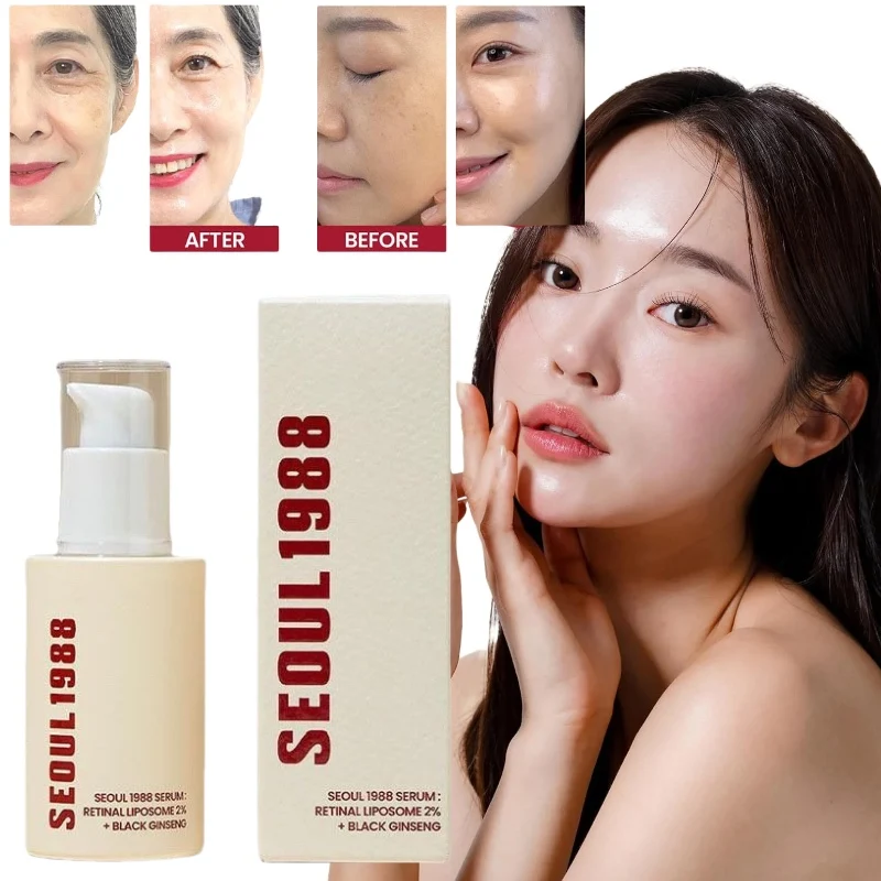 

Korean SEOUL 1988 Serum Black Ginseng 2% Nicotinamide Removal Fade Melasma Dark Spots Corrector Soothing and Balancing Skin Care