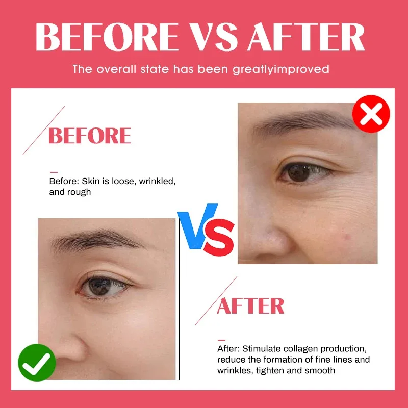 Siero di acido ialuronico con fiala a sei peptidi per il viso Dr Pen SNAIL ACNE Soluzione Riparazione idratante Cura della pelle Scatola coreana da 10 pezzi