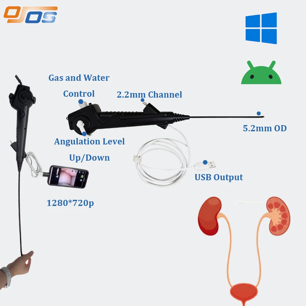 5.2mm USB HD Cystoscope  1080P 30Fps USB Endoscopy System for Surgical Instruments