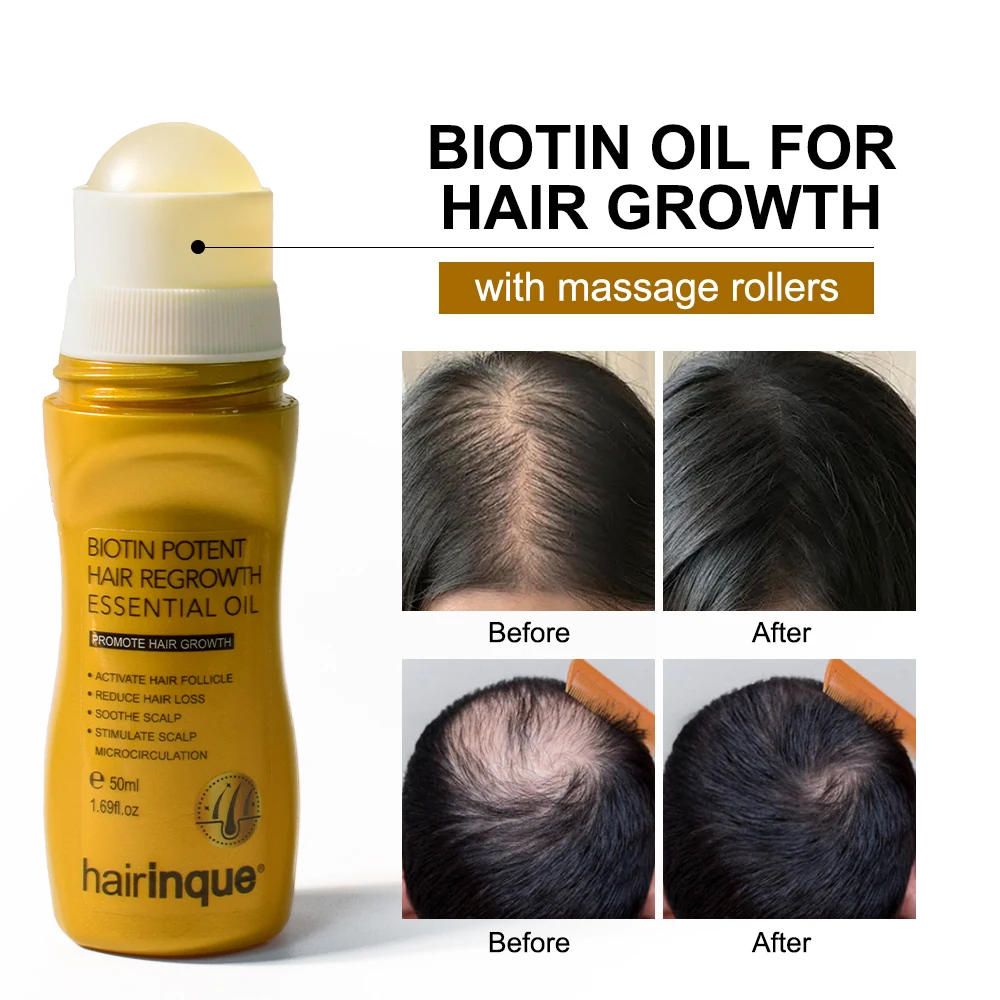 Biotin Hair Growth Products for Men Women Anti Hair Loss Fast Regrowth Thicken Oils Scalp Treatment Serum Hair Care