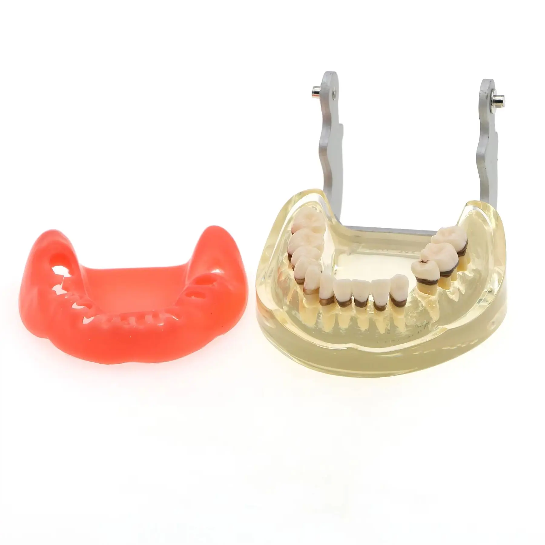 

Модель зубов Typodont для взрослых, патологические заболевания пародонта, исследование зубов, обучающая модель M4017