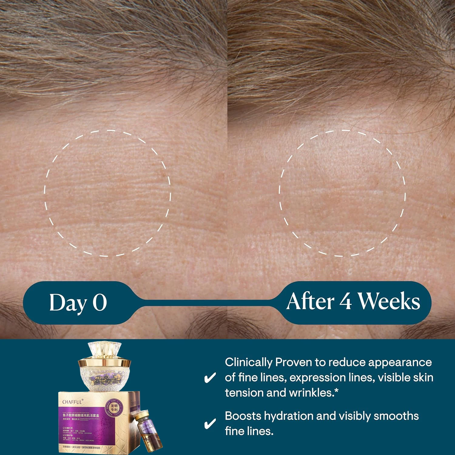 Caviar Collagen Cell Filling Cream 50ml+ Firming Oil 5ml Facial Care Lifting Firming Cream Wrinkle Remover Face Cream Skin