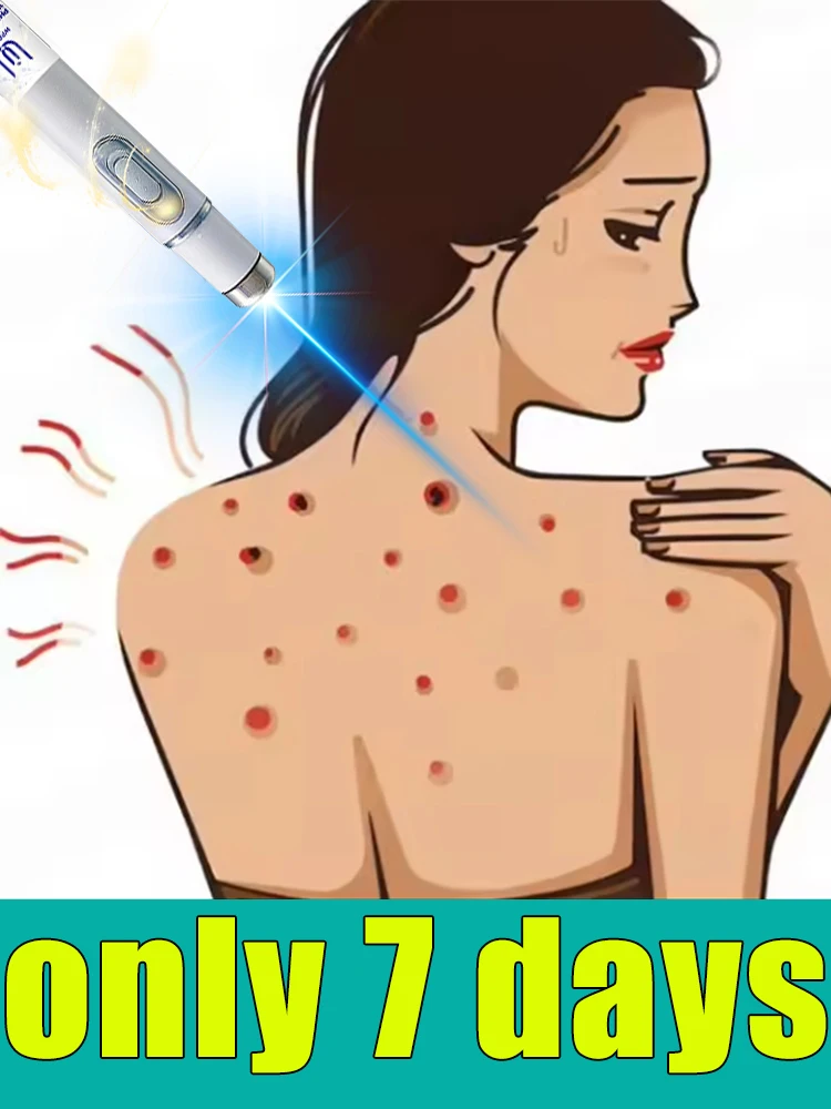 

Blue light pen for wart removal treatment, free shipping, painless